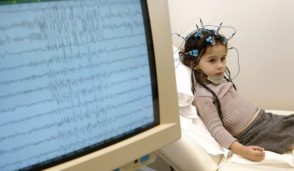 Electroencephalogram (EEG) on a 4-year old girl. Epilepsy tracing on the screen.