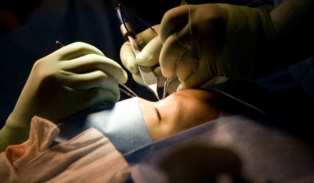 Surgeons performing operation on pediatric patient