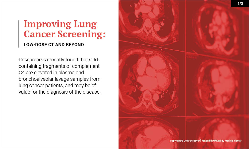 Graphic on improvements in lung cancer screening