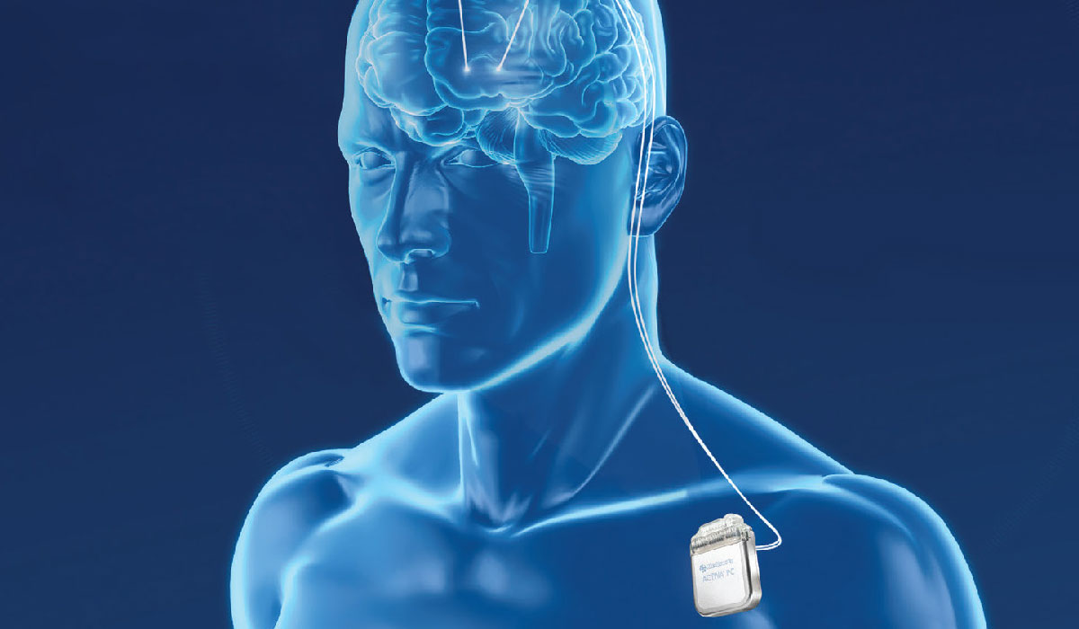 Discoveries in Medicine From Hope to Practice Deep Brain Stimulation