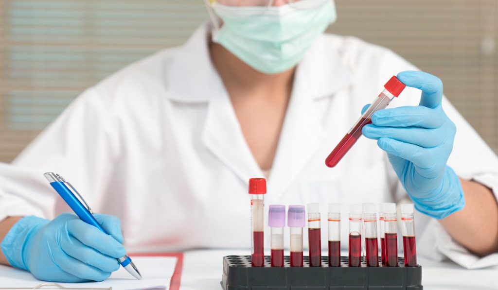 Laboratory Worker with blood vials and notepad