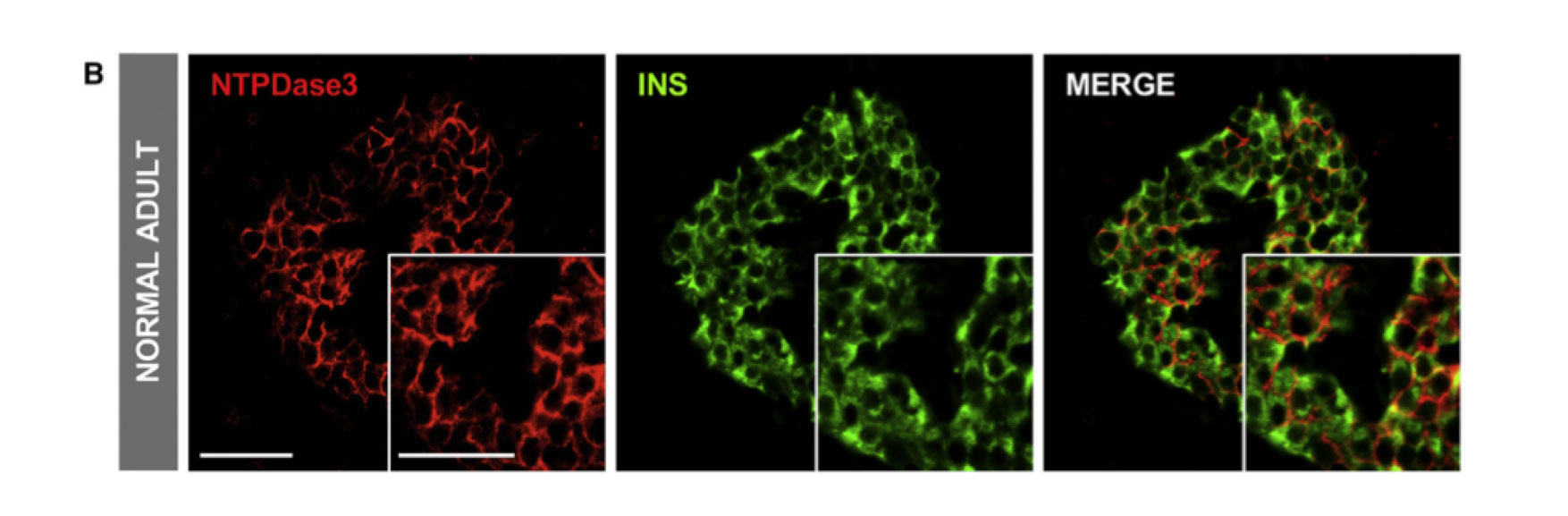 Analyzing Beta Cells In Vivo May Change Diabetes Research