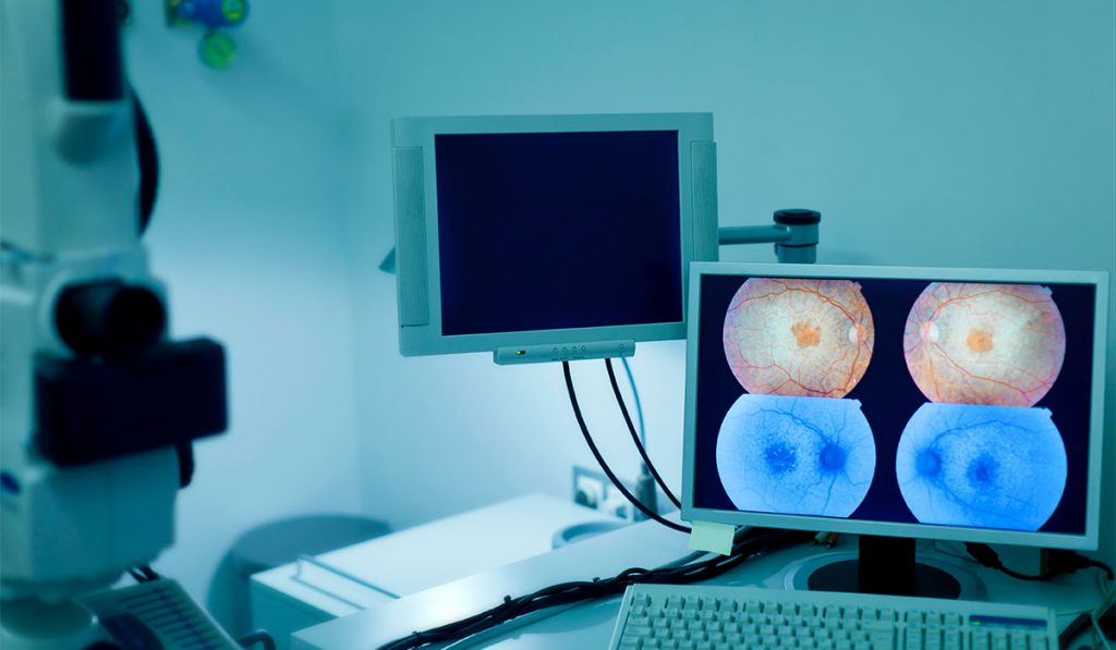Medical imaging examining retinal scan.