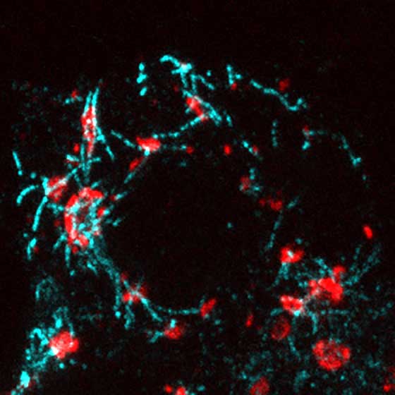Glucose Triggers More Microtubules and Insulin Release