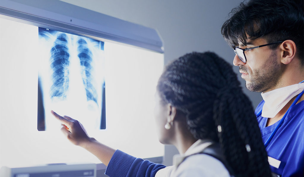 Two physicians looking at lung xray to identify ILD or other lung diseases.