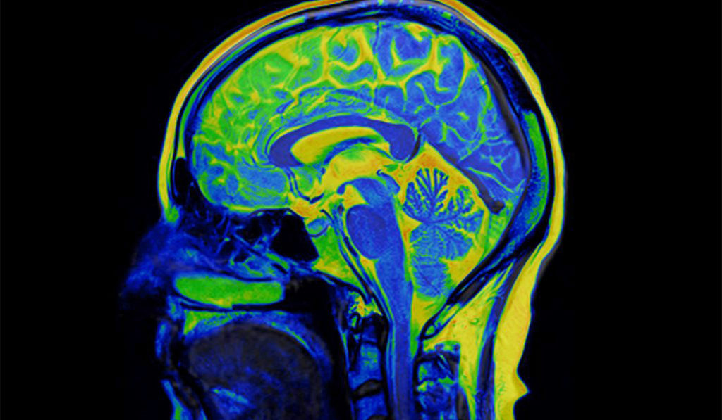 Brain MRI Scan of Healthy Male ( Magnetic Resonance Imaging) High Resolution