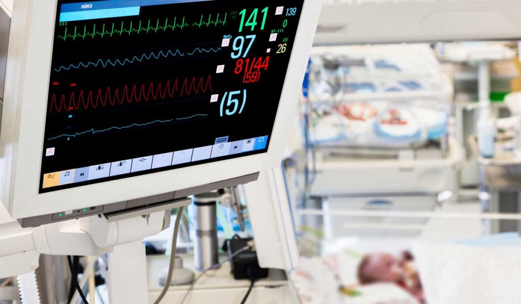 Heart monitor of a newborn baby.