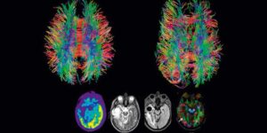 Scan of the brain