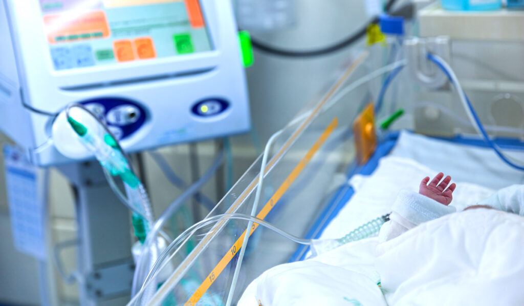 Infant in NICU connected to monitors