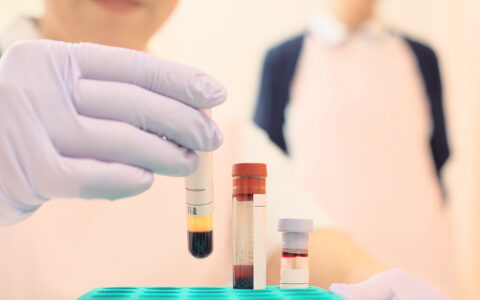 Lab equipment tubes in a lab