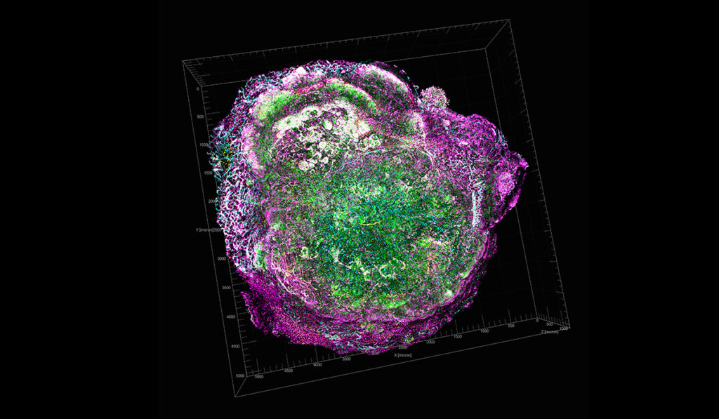 Transparent tumor tomography visualising tumor microenvironment, showing a mouse model for HER2-positive breast cancer