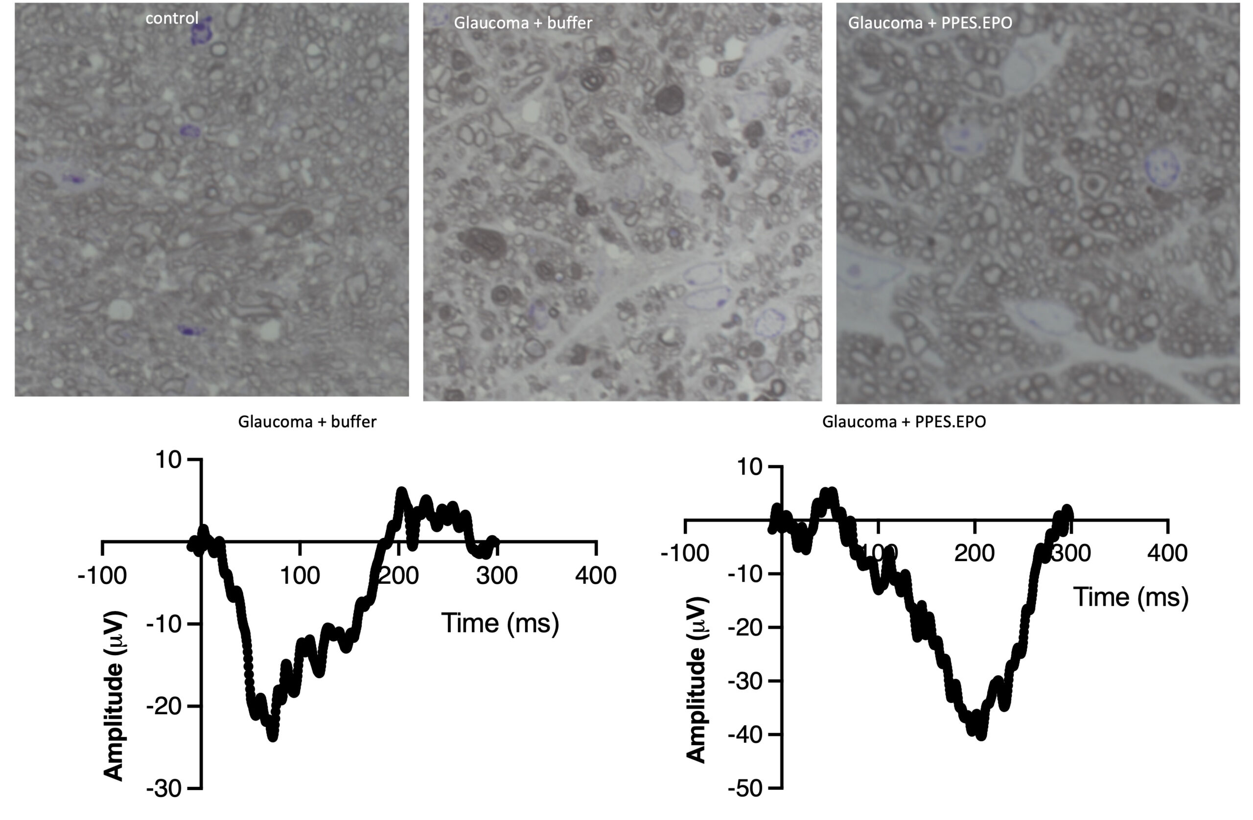 Antioxidant Microparticles May Protect Vision After IED Blast Exposure