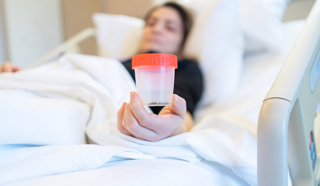Woman with cup of kidney stones