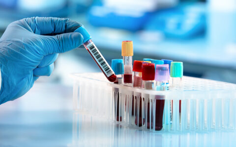 blood samples in tubes
