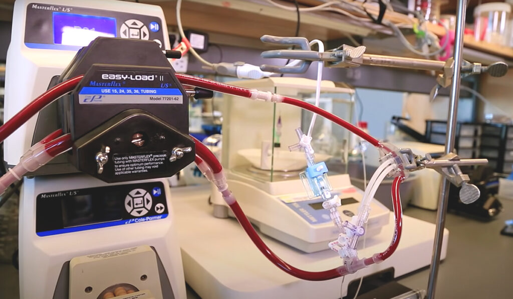Image of artificial kidney attached to dialysis machine