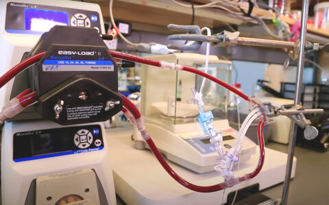 Image of artificial kidney attached to dialysis machine