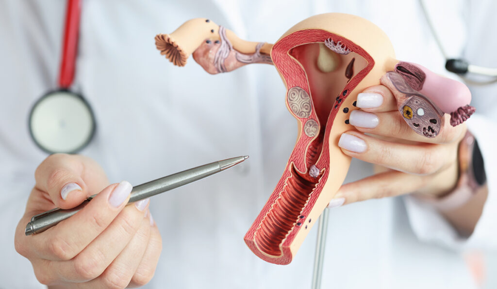 Physician pointing at model of uterus