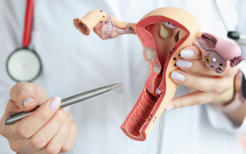 Physician pointing at model of uterus