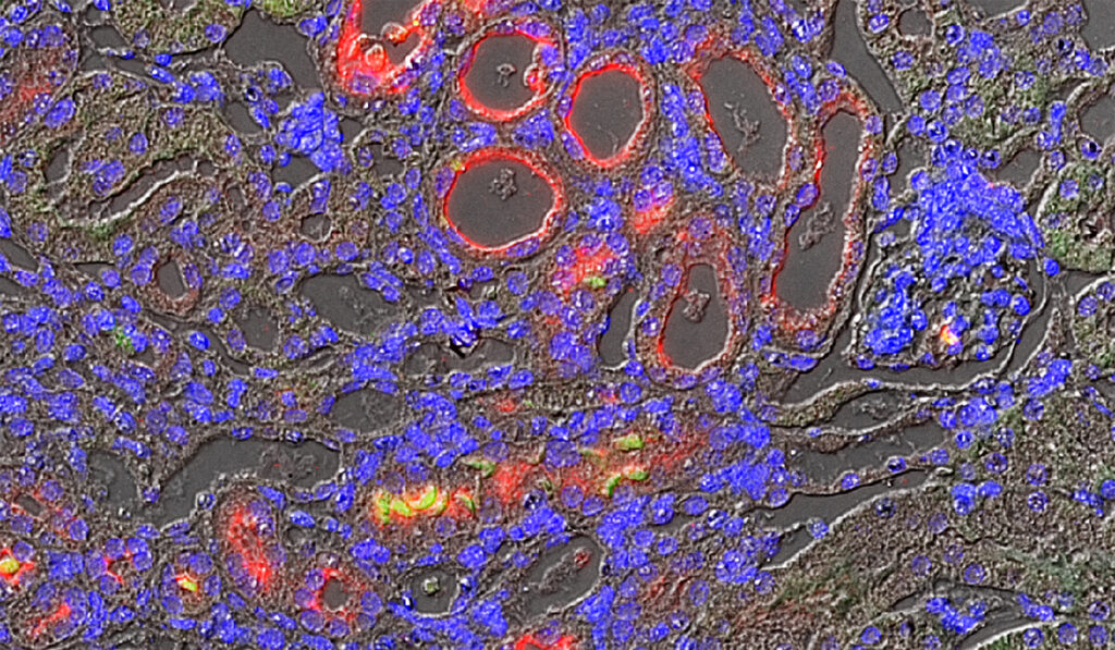 Mouse kidney sections stained for kidney injury molecule-1 (KIM-1) (red), dying cells (green), and nuclei (blue).