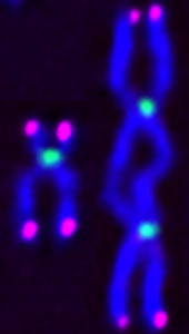 Normal chromosome on the left, and dicentric chromosome after loss of SETD2 activity on the right.