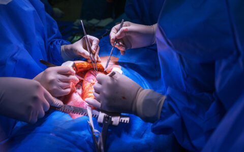 Surgery team performing heart transplant