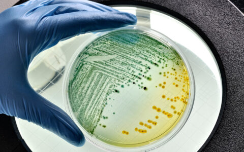 A scientist's gloved hand reaching for a petri dish of E. coli