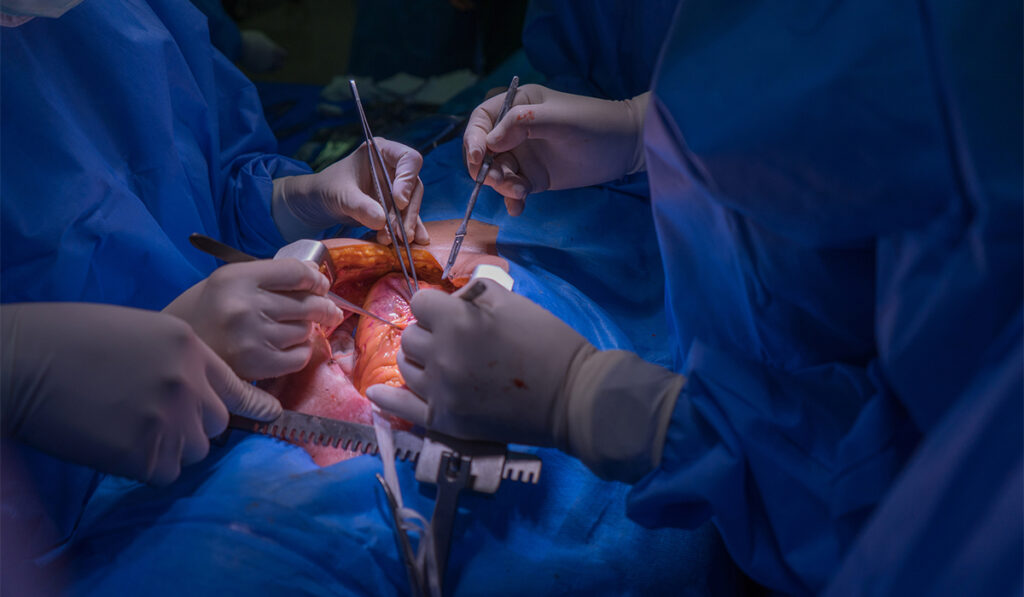 Heart surgery operation