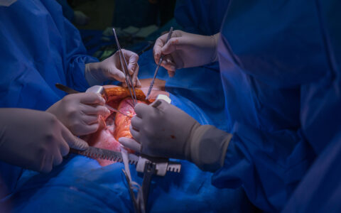 Heart surgery operation